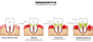 periodontist costa rica