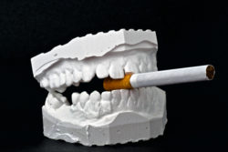 Smoking and Dental Implants